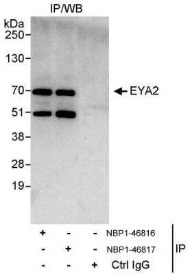 Immunoprecipitation: EYA2 Antibody [NBP1-46816]