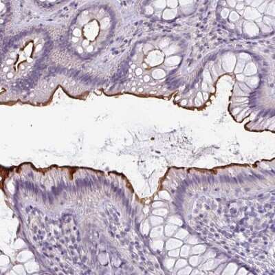Immunohistochemistry-Paraffin: EYA3 Antibody [NBP2-47464]
