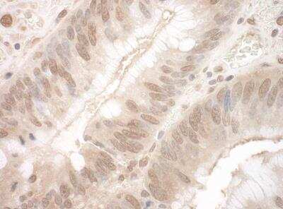 Immunohistochemistry-Paraffin: EYA3 Antibody [NBP1-46818]