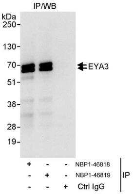 Immunoprecipitation: EYA3 Antibody [NBP1-46819]