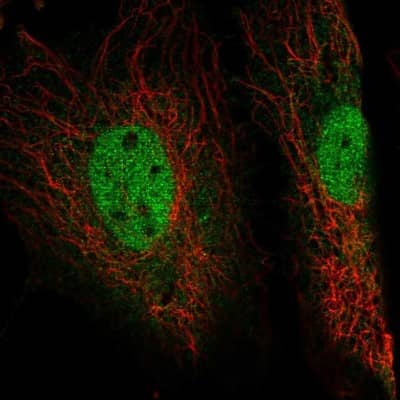 Immunocytochemistry/ Immunofluorescence: EYA4 Antibody [NBP1-85548]