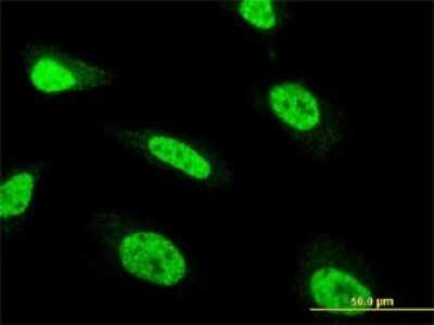 Immunocytochemistry/ Immunofluorescence: EZFIT/ZNF71 Antibody (3F4) [H00058491-M01]