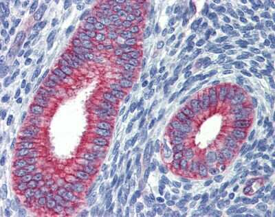 Immunohistochemistry: EZFIT/ZNF71 Antibody [NBP1-80358]