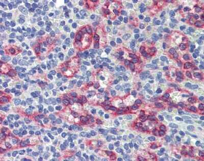 Immunohistochemistry: EZFIT/ZNF71 Antibody [NBP1-80358]