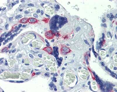 Immunohistochemistry: EZFIT/ZNF71 Antibody [NBP1-80358]
