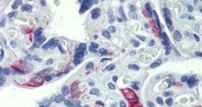 Immunohistochemistry-Paraffin: EZFIT/ZNF71 Antibody [NBP1-80358]