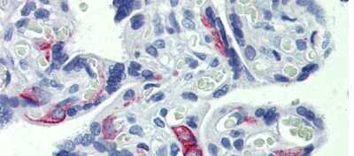 Immunohistochemistry-Paraffin: EZFIT/ZNF71 Antibody [NBP1-80358]