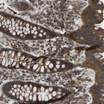 Immunohistochemistry-Paraffin: EZFIT/ZNF71 Antibody [NBP1-85504]