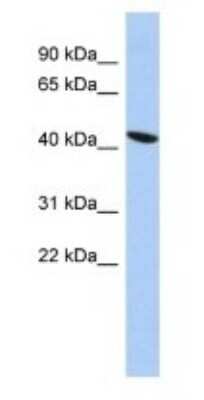 Western Blot: EZFIT/ZNF71 Antibody [NBP1-80358]