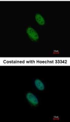 Immunocytochemistry/ Immunofluorescence: EZH1 Antibody [NBP1-32111]