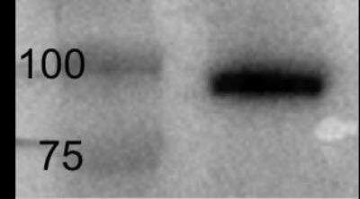 Western Blot: EZH1 Antibody [NB100-56358]