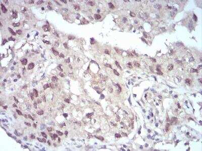 Immunohistochemistry: EZH2/KMT6 Antibody (6G4F4) - BSA Free [NBP2-52463]