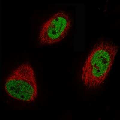 Immunocytochemistry/ Immunofluorescence: EZH2/KMT6 Antibody (CL11960) [NBP3-15125]