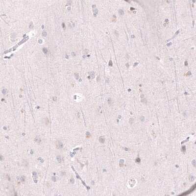 Immunohistochemistry-Paraffin: EZH2/KMT6 Antibody (CL11960) [NBP3-15125]