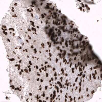 Immunohistochemistry-Paraffin: EZH2/KMT6 Antibody (CL11960) [NBP3-15125]