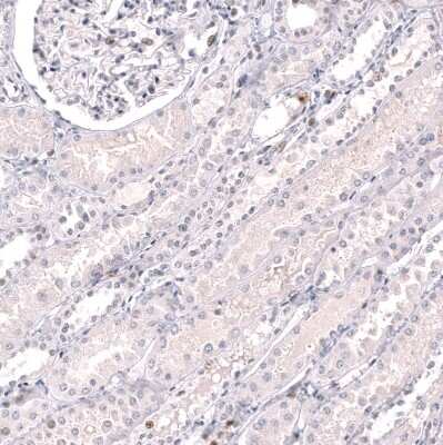 Immunohistochemistry-Paraffin: EZH2/KMT6 Antibody (CL11960) [NBP3-15125]