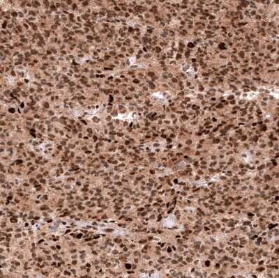 Immunohistochemistry-Paraffin: EZH2/KMT6 Antibody (CL11960) [NBP3-15125]