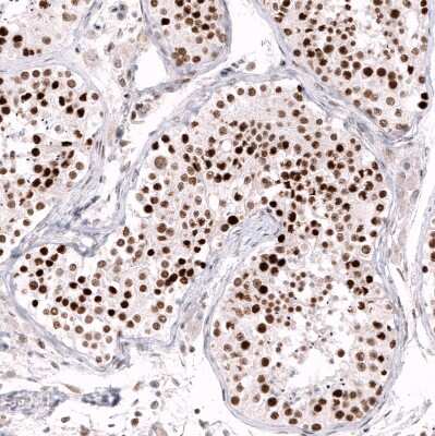 Immunohistochemistry-Paraffin: EZH2/KMT6 Antibody (CL11960) [NBP3-15125]