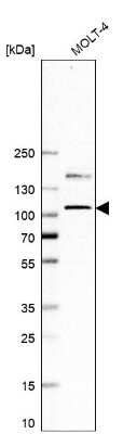 Western Blot: EZH2/KMT6 Antibody (CL11960) [NBP3-15125]