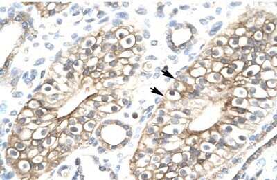 Immunohistochemistry-Paraffin: Eaf6 Antibody [NBP1-91523]