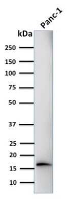 Western Blot: Elastase Antibody (CELA3B/1218)Azide and BSA Free [NBP2-47938]