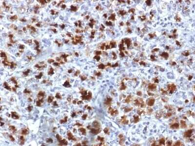 Immunohistochemistry-Paraffin: Elastase Antibody (CELA3B/1757) [NBP2-53193]