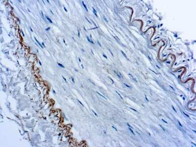 Immunohistochemistry-Paraffin: Elastin Antibody (BA-4) [NB100-2076]