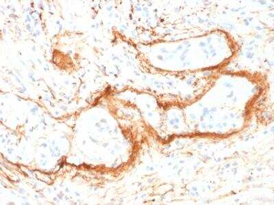 Immunohistochemistry-Paraffin: Elastin Antibody (ELN/1981) [NBP2-75767]