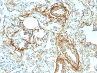 Immunohistochemistry-Paraffin: Elastin Antibody (ELN/2069) [NBP3-07147]