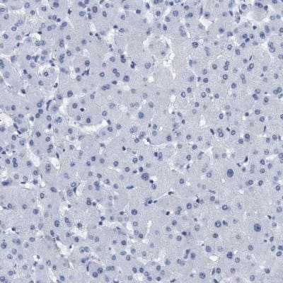 Immunohistochemistry-Paraffin: Elastin Antibody [NBP1-80710]