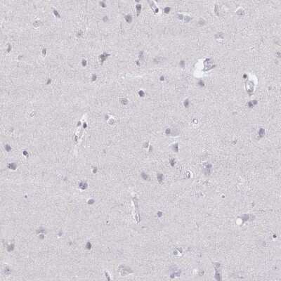 Immunohistochemistry-Paraffin: Elf4/MEF Antibody [NBP2-33286]