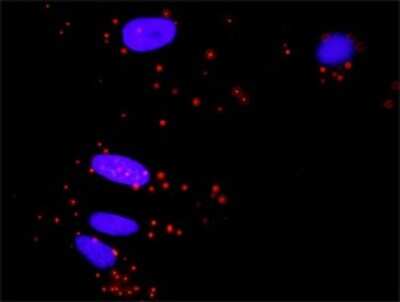 Proximity Ligation Assay: Elk-1 Antibody (2G6) [H00002002-M01]