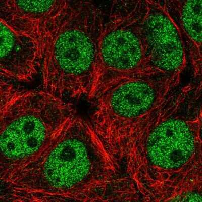 Immunocytochemistry/ Immunofluorescence: Elk-1 Antibody [NBP2-38278]