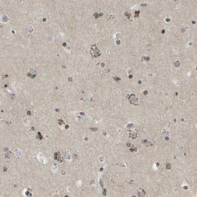 Immunohistochemistry-Paraffin: Ellis van Creveld syndrome Antibody [NBP1-84038]