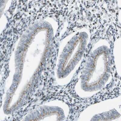 Immunohistochemistry-Paraffin: Ellis van Creveld syndrome Antibody [NBP1-84038]