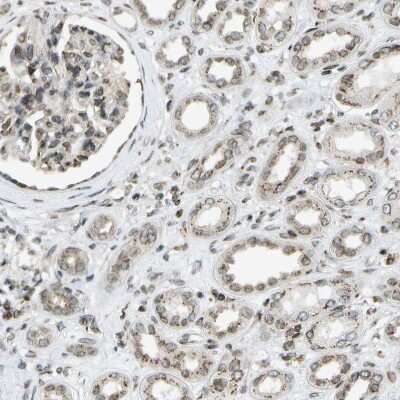Immunohistochemistry-Paraffin: Ellis van Creveld syndrome Antibody [NBP1-84038]
