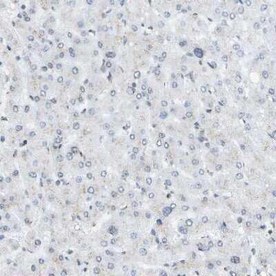 Immunohistochemistry-Paraffin: Ellis van Creveld syndrome Antibody [NBP1-84038]