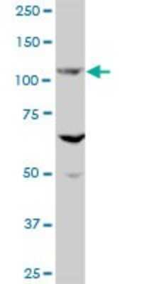 Western Blot: Ellis van Creveld syndrome Antibody [H00002121-B01P]