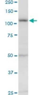 Western Blot: Ellis van Creveld syndrome Antibody [H00002121-B01P]