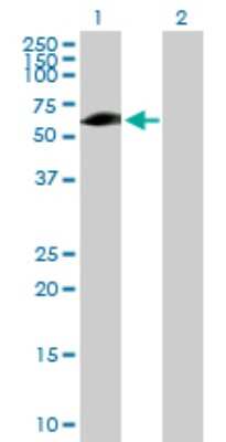 Western Blot: Ellis van Creveld syndrome Antibody [H00002121-B01P]