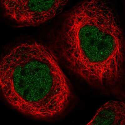 Immunocytochemistry/ Immunofluorescence: Elp4 Antibody [NBP2-47473]