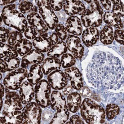 Immunohistochemistry-Paraffin: Elp4 Antibody [NBP2-47473]