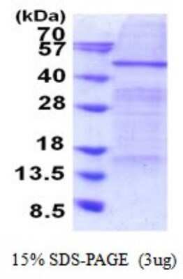 SDS-PAGE: Recombinant Human Elp4 His Protein [NBP2-51857]