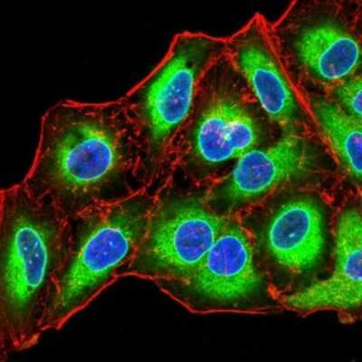 Immunocytochemistry/ Immunofluorescence: Emerin Antibody (8F5A8) - BSA Free [NBP2-52459]