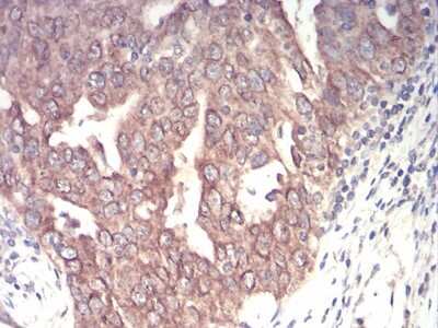 Immunohistochemistry: Emerin Antibody (8F5A8) - BSA Free [NBP2-52459]