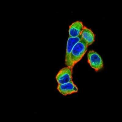 Immunocytochemistry/ Immunofluorescence: Emerin Antibody (8F5G2) - BSA Free [NBP2-52460]