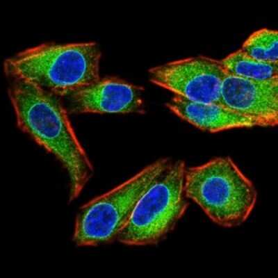 Immunocytochemistry/ Immunofluorescence: Emerin Antibody (8F5G2) - BSA Free [NBP2-52460]