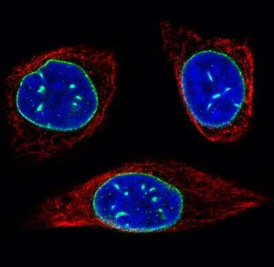 Immunocytochemistry/ Immunofluorescence: Emerin Antibody (CL0201) [NBP2-52876]