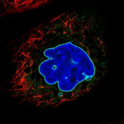 Immunocytochemistry/ Immunofluorescence: Emerin Antibody (CL0203) [NBP2-52877]