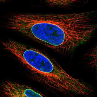 Immunocytochemistry/ Immunofluorescence: Emerin Antibody (CL0203) [NBP2-52877]